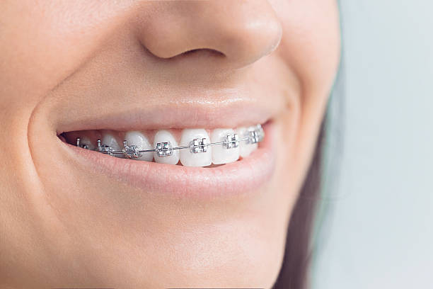 Best Wisdom Tooth Removal  in Centralia, WA